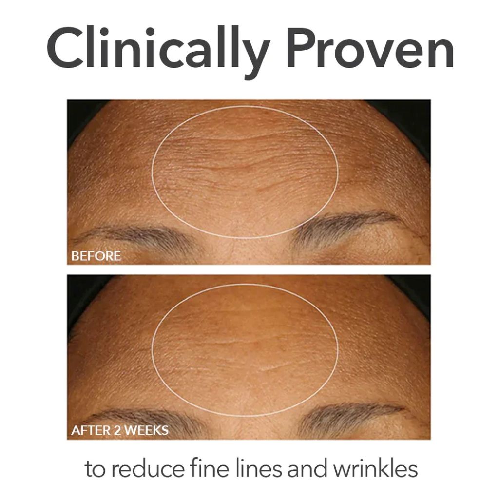 Dr Gross Alpha Beta Extra Strength Daily Peel Clinical Proven